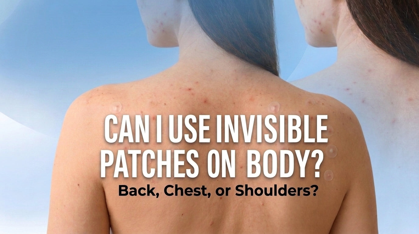 Can I Use Invisible Patches on My Back, Chest &amp; Shoulders?