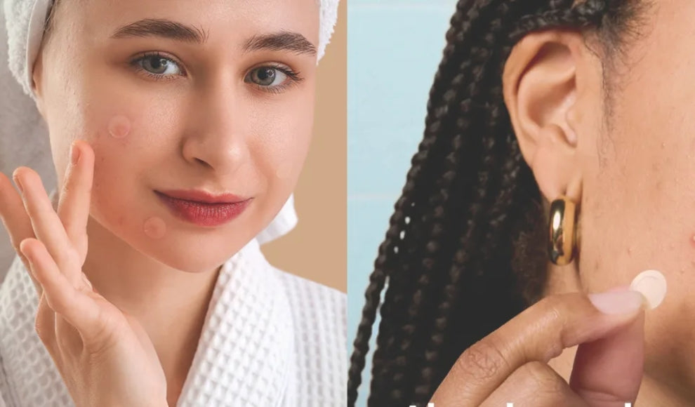 Why Transdermal Patches Are Disrupting the Skincare Industry