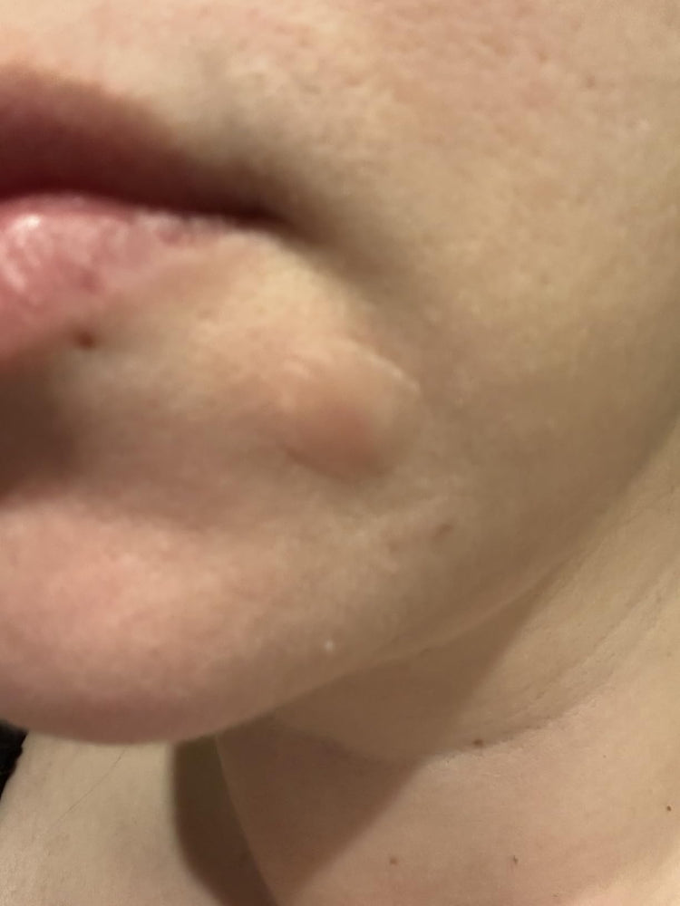 Close-up of a person's mouth and chin area