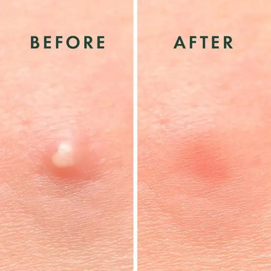 Before and after comparison of skin texture on a pink background
