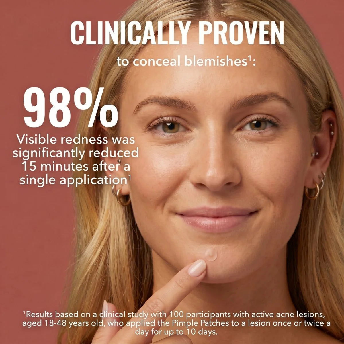 Blonde woman smiling showing Zovira pimple patch on chin with text: Clinically Proven 98% redness reduction in 15 minutes