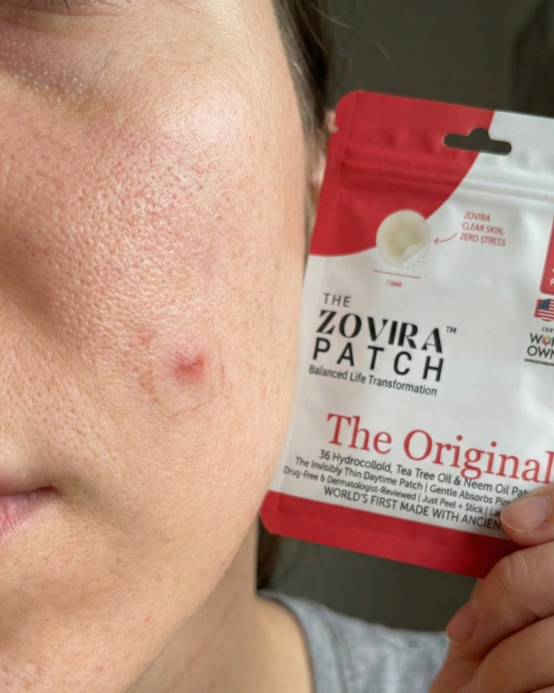 ZOVIRA